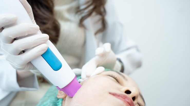 laser treatment for acne scars